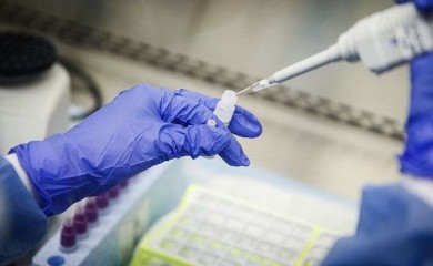 Наплаћује се само комерцијално тестирање на вирус корона