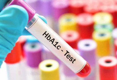 Почиње мјерење „HbA1c“ гликолизираног хемоглобина